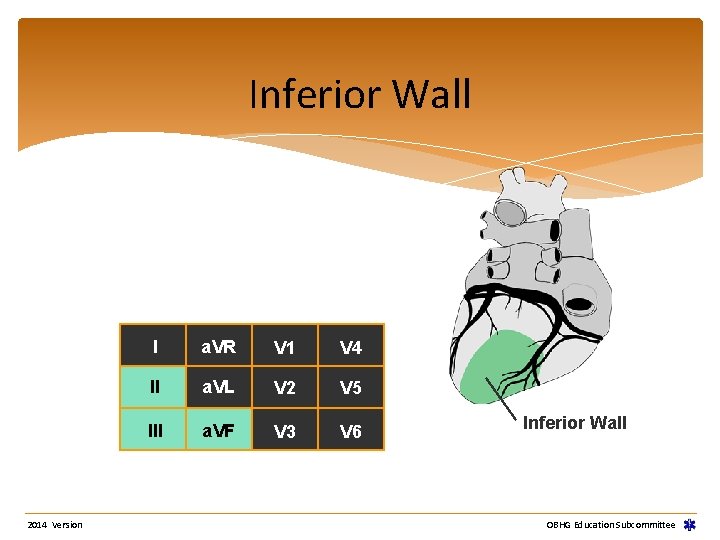 Inferior Wall 2014 Version I a. VR V 1 V 4 II a. VL Inferior Wall 2014 Version I a. VR V 1 V 4 II a. VL