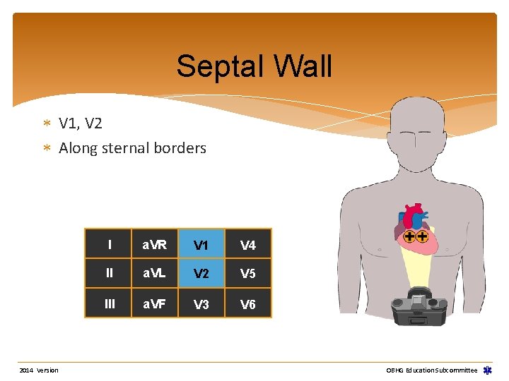 Septal Wall V 1, V 2 Along sternal borders 2014 Version I a. VR Septal Wall V 1, V 2 Along sternal borders 2014 Version I a. VR