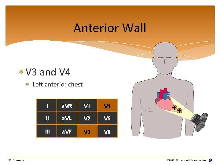 Anterior Wall V 3 and V 4 Left anterior chest 2014 Version I a. Anterior Wall V 3 and V 4 Left anterior chest 2014 Version I a.