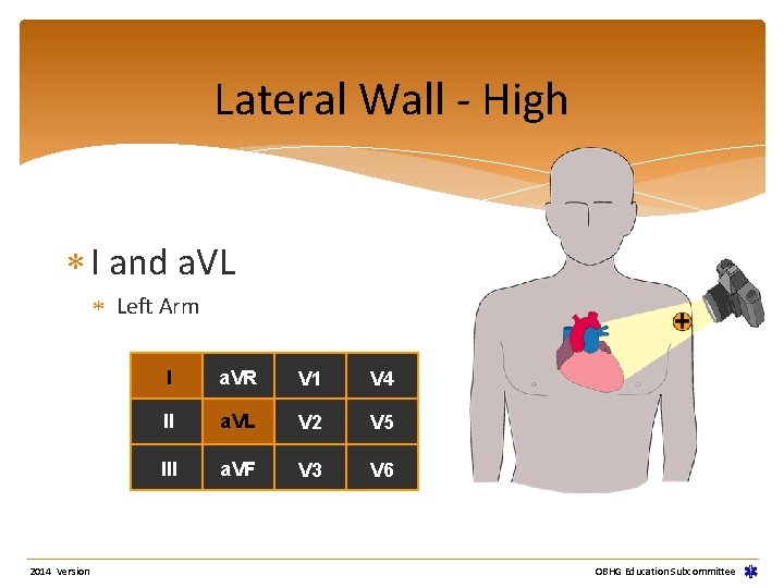 Lateral Wall - High I and a. VL Left Arm 2014 Version I a. Lateral Wall - High I and a. VL Left Arm 2014 Version I a.
