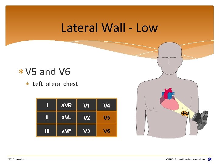 Lateral Wall - Low V 5 and V 6 Left lateral chest 2014 Version Lateral Wall - Low V 5 and V 6 Left lateral chest 2014 Version