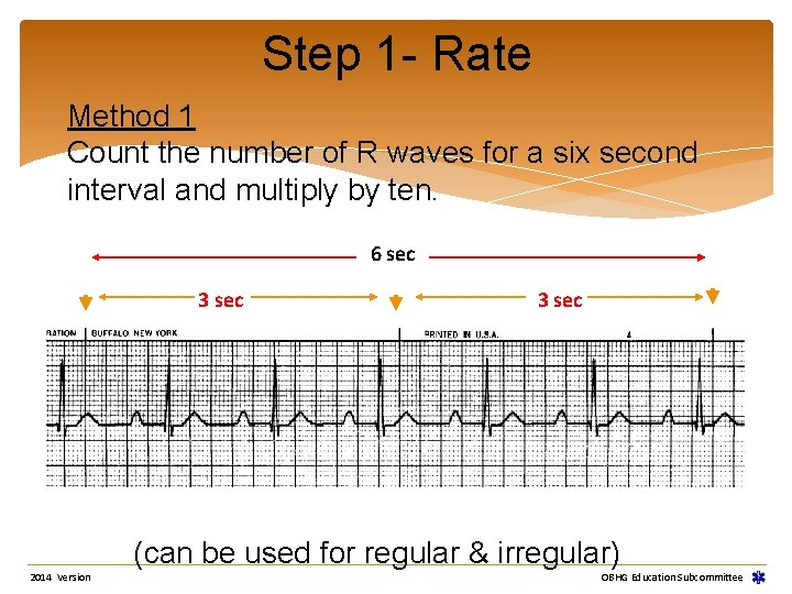 Step 1 - Rate Method 1 Count the number of R waves for a Step 1 - Rate Method 1 Count the number of R waves for a