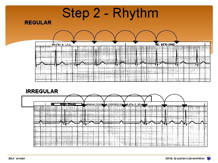 REGULAR Step 2 - Rhythm IRREGULAR 2014 Version OBHG Education Subcommittee REGULAR Step 2 - Rhythm IRREGULAR 2014 Version OBHG Education Subcommittee