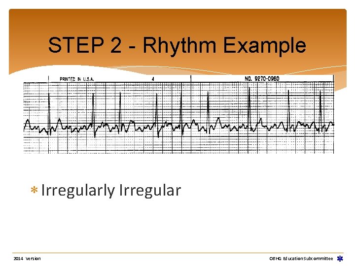 STEP 2 - Rhythm Example Irregularly Irregular 2014 Version OBHG Education Subcommittee STEP 2 - Rhythm Example Irregularly Irregular 2014 Version OBHG Education Subcommittee