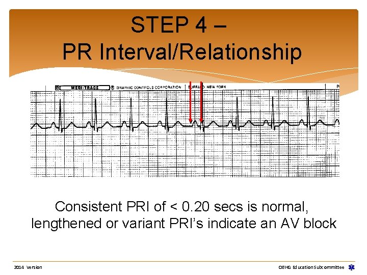 STEP 4 – PR Interval/Relationship Consistent PRI of < 0. 20 secs is normal, STEP 4 – PR Interval/Relationship Consistent PRI of < 0. 20 secs is normal,