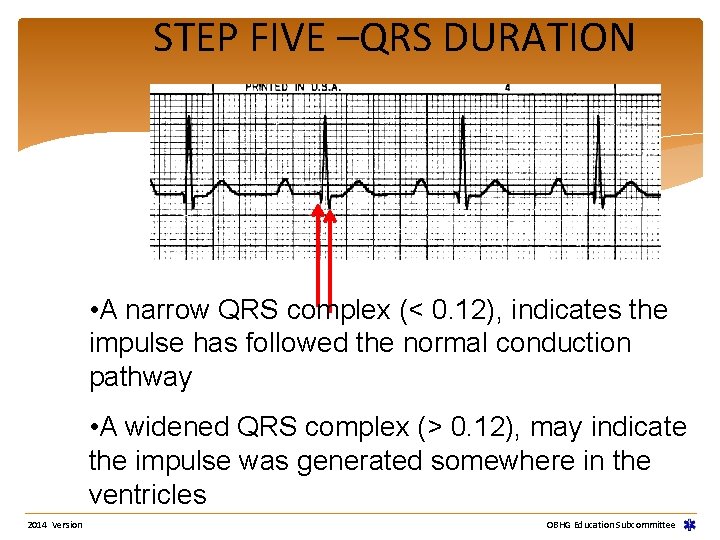 STEP FIVE –QRS DURATION • A narrow QRS complex (< 0. 12), indicates the STEP FIVE –QRS DURATION • A narrow QRS complex (< 0. 12), indicates the