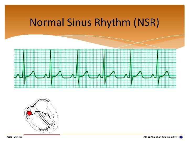 Normal Sinus Rhythm (NSR) 2014 Version OBHG Education Subcommittee Normal Sinus Rhythm (NSR) 2014 Version OBHG Education Subcommittee