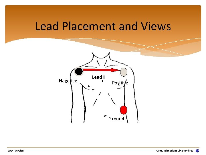 Lead Placement and Views Negative Lead I Positive Ground 2014 Version OBHG Education Subcommittee Lead Placement and Views Negative Lead I Positive Ground 2014 Version OBHG Education Subcommittee