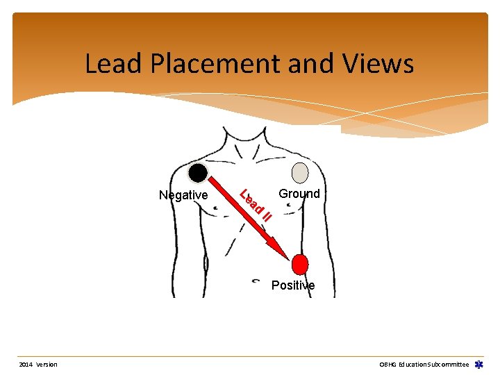 Lead Placement and Views Negative Le ad Ground II Positive 2014 Version OBHG Education Lead Placement and Views Negative Le ad Ground II Positive 2014 Version OBHG Education