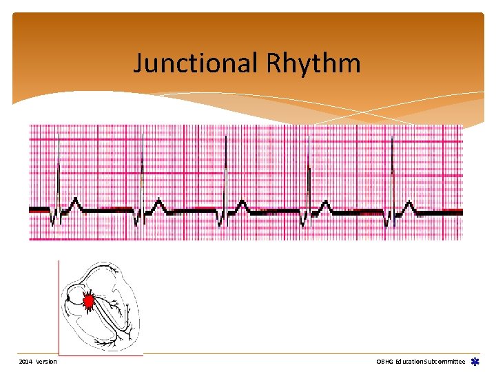 Junctional Rhythm 2014 Version OBHG Education Subcommittee Junctional Rhythm 2014 Version OBHG Education Subcommittee