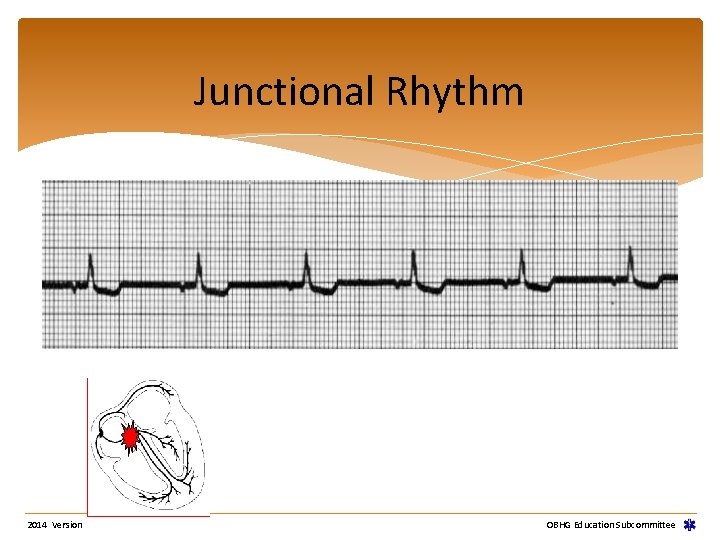 Junctional Rhythm 2014 Version OBHG Education Subcommittee Junctional Rhythm 2014 Version OBHG Education Subcommittee