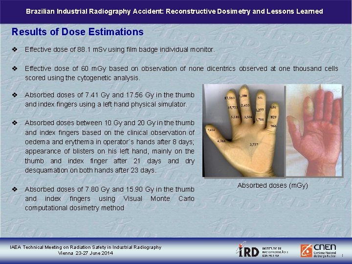 Brazilian Industrial Radiography Accident: Reconstructive Dosimetry and Lessons Learned Results of Dose Estimations v