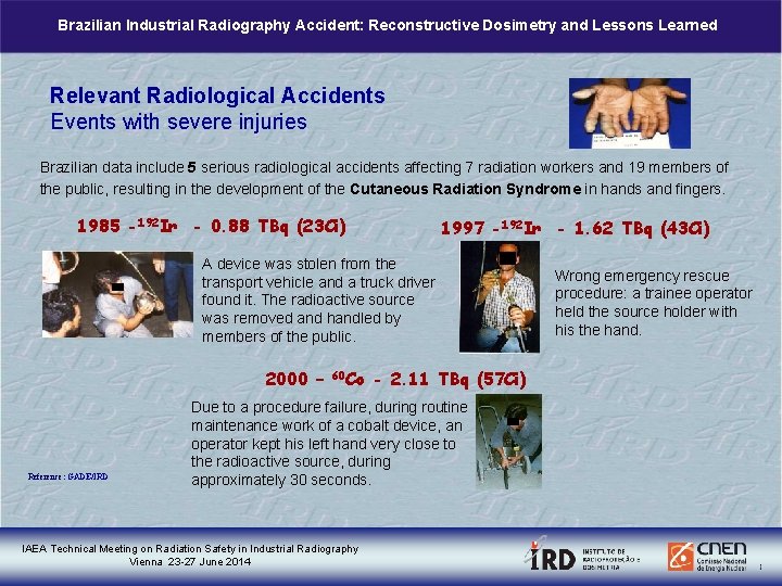 Brazilian Industrial Radiography Accident: Reconstructive Dosimetry and Lessons Learned Relevant Radiological Accidents Events with