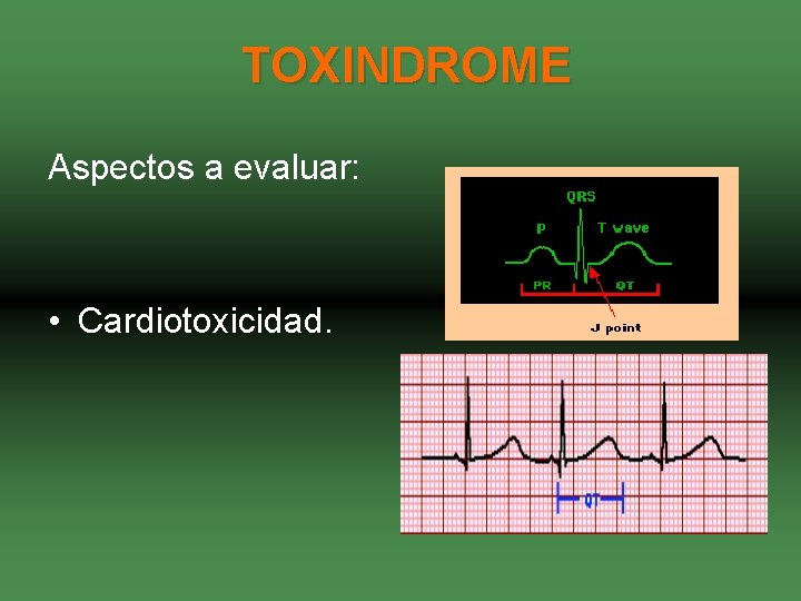 TOXINDROME Aspectos a evaluar: • Cardiotoxicidad. 