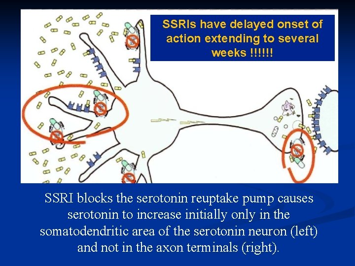 SSRIs have delayed onset of action extending to several weeks !!!!!! SSRI blocks the