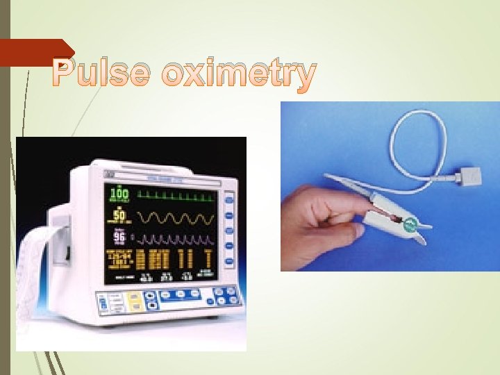 Pulse oximetry 