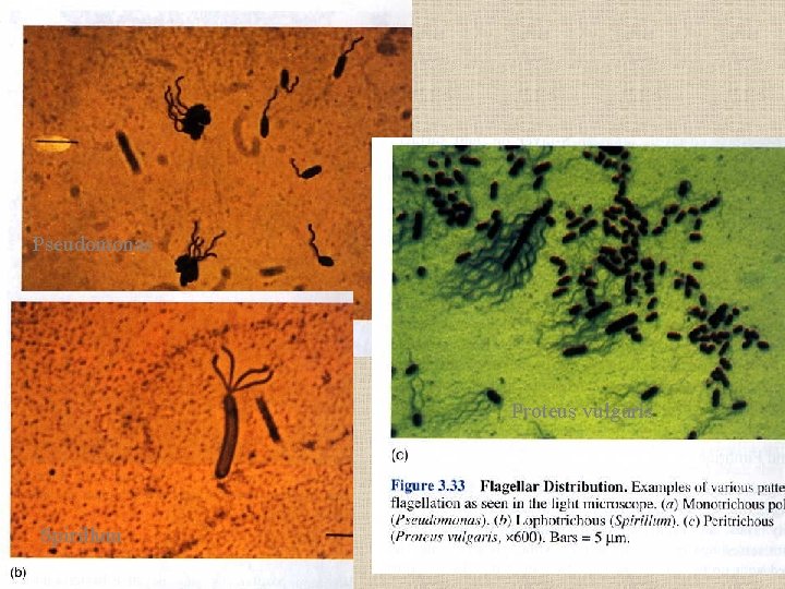 Pseudomonas Proteus vulgaris Spirillum 