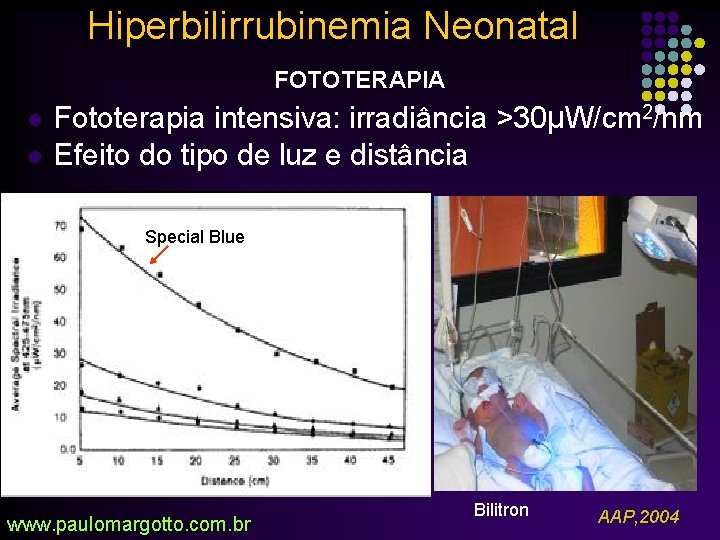 Hiperbilirrubinemia Neonatal FOTOTERAPIA l l Fototerapia intensiva: irradiância >30µW/cm 2/nm Efeito do tipo de