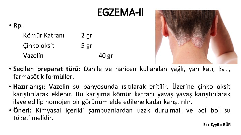 EGZEMA-II • Rp. Kömür Katranı Çinko oksit Vazelin 2 gr 5 gr 40 gr