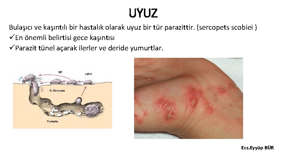 UYUZ Bulaşıcı ve kaşıntılı bir hastalık olarak uyuz bir tür parazittir. (sercopets scobiei )