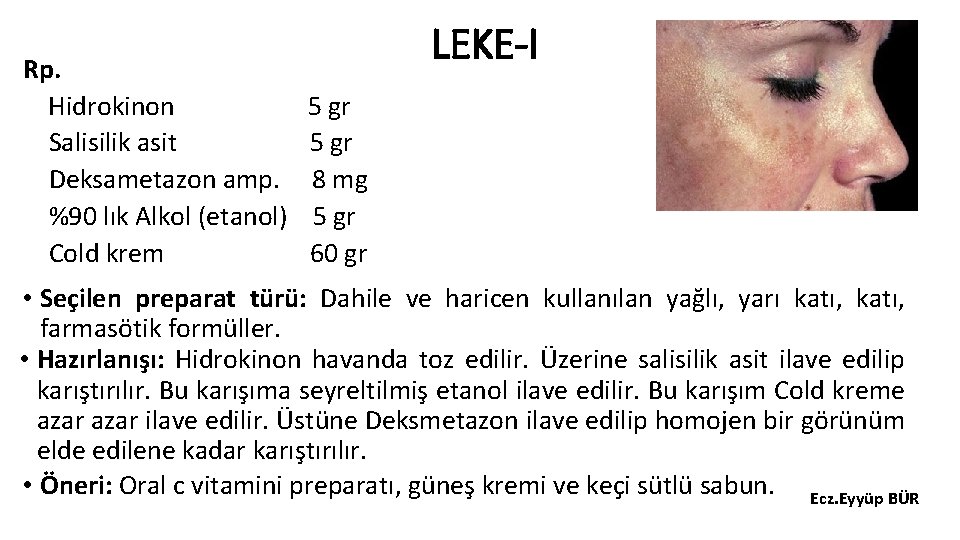 Rp. Hidrokinon Salisilik asit Deksametazon amp. %90 lık Alkol (etanol) Cold krem LEKE-I 5