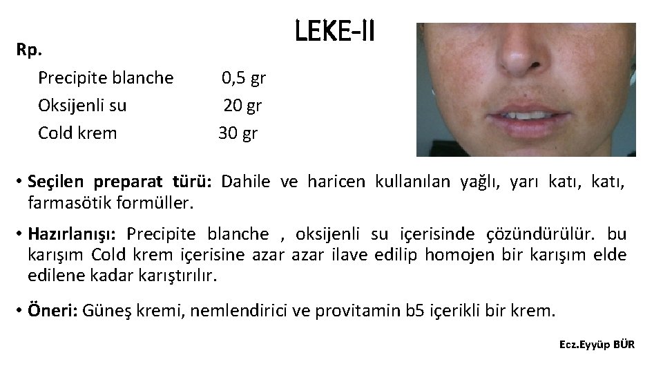 Rp. Precipite blanche Oksijenli su Cold krem LEKE-II 0, 5 gr 20 gr 30