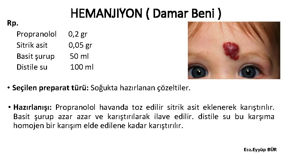 Rp. Propranolol Sitrik asit Basit şurup Distile su HEMANJIYON ( Damar Beni ) 0,