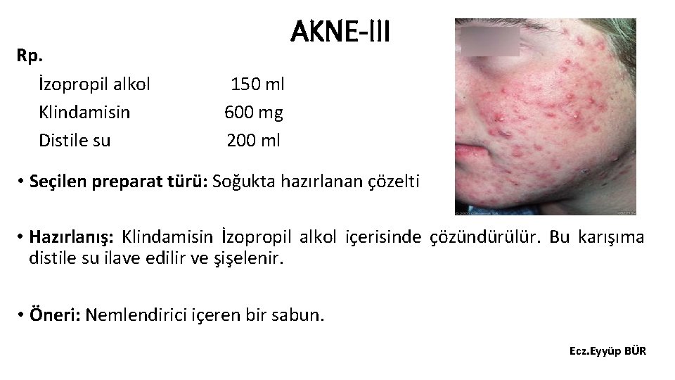 Rp. İzopropil alkol Klindamisin Distile su AKNE-III 150 ml 600 mg 200 ml •