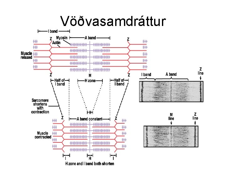 Vöðvasamdráttur 