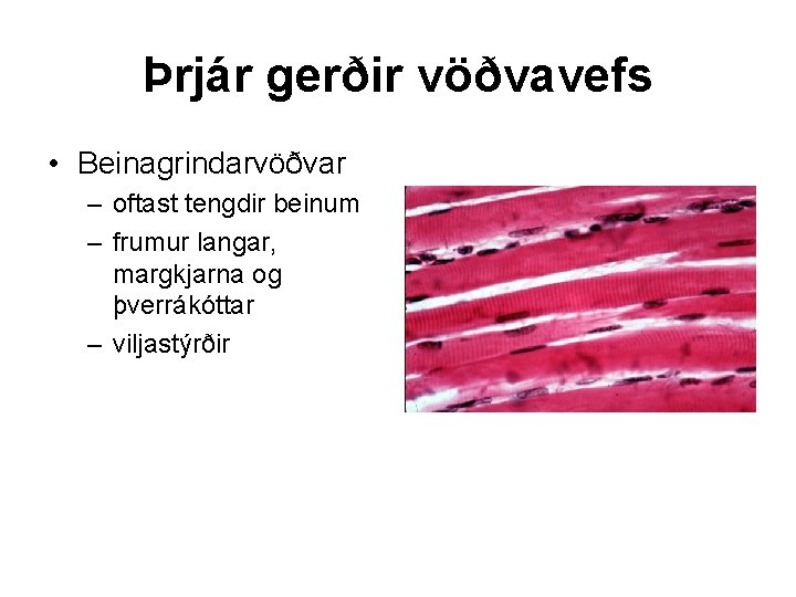Þrjár gerðir vöðvavefs • Beinagrindarvöðvar – oftast tengdir beinum – frumur langar, margkjarna og