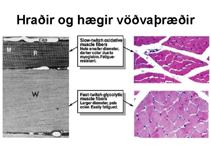 Hraðir og hægir vöðvaþræðir 