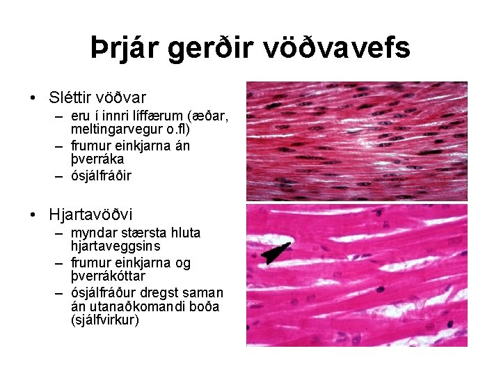 Þrjár gerðir vöðvavefs • Sléttir vöðvar – eru í innri líffærum (æðar, meltingarvegur o.