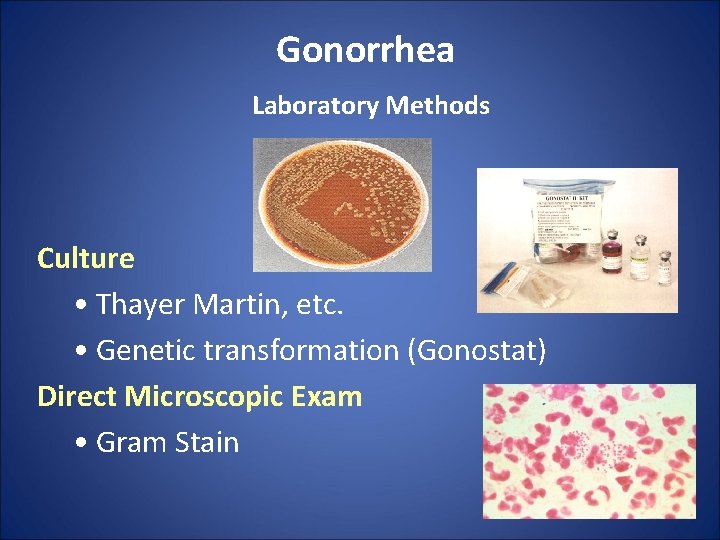 Gonorrhea Laboratory Methods Culture • Thayer Martin, etc. • Genetic transformation (Gonostat) Direct Microscopic