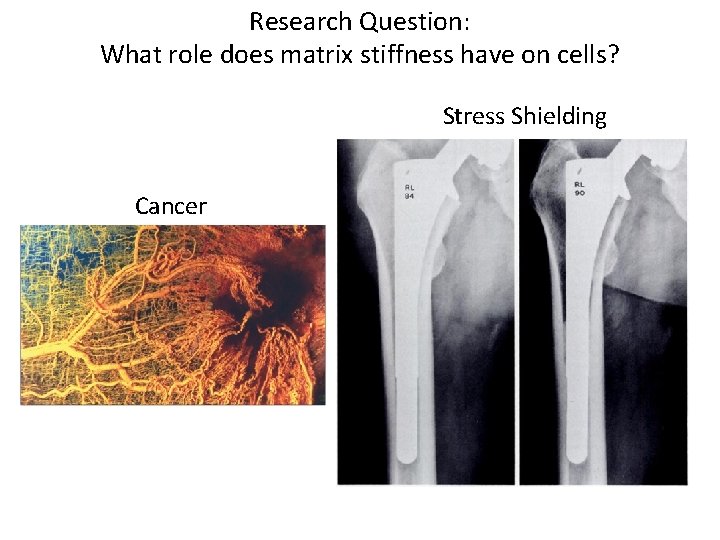 Research Question: What role does matrix stiffness have on cells? Stress Shielding Cancer 