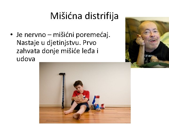 Mišićna distrifija • Je nervno – mišićni poremećaj. Nastaje u djetinjstvu. Prvo zahvata donje