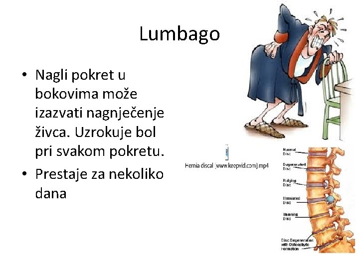 Lumbago • Nagli pokret u bokovima može izazvati nagnječenje živca. Uzrokuje bol pri svakom