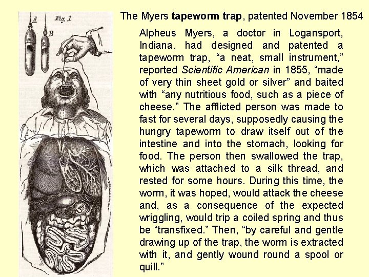 The Myers tapeworm trap, patented November 1854 Alpheus Myers, a doctor in Logansport, Indiana,