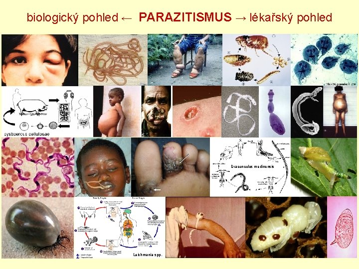 biologický pohled ← PARAZITISMUS → lékařský pohled Dracunculus medinensis Leishmania spp. 