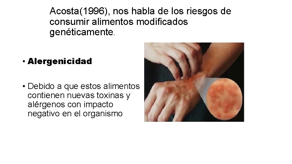 Acosta(1996), nos habla de los riesgos de consumir alimentos modificados genéticamente. • Alergenicidad •