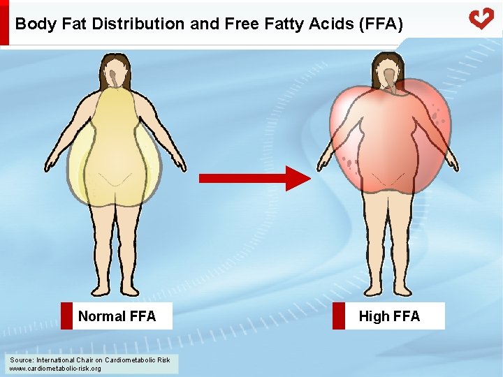 Body Fat Distribution and Free Fatty Acids (FFA) Normal FFA Source: International Chair on