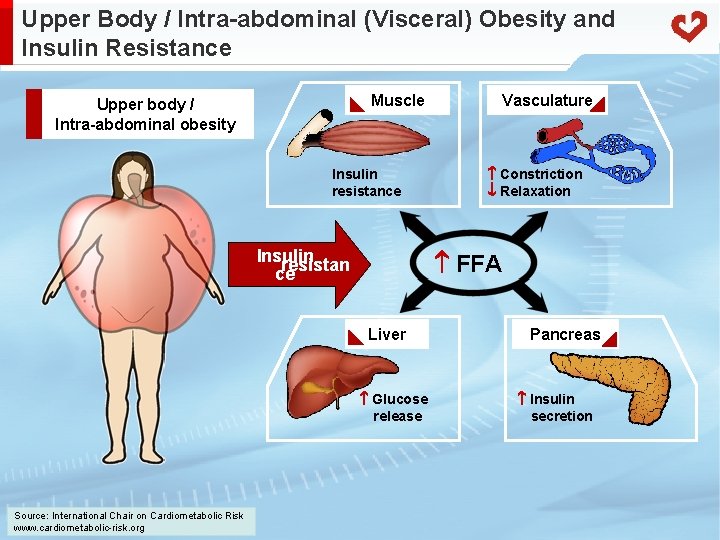 Upper Body / Intra-abdominal (Visceral) Obesity and Insulin Resistance Muscle Upper body / Intra-abdominal