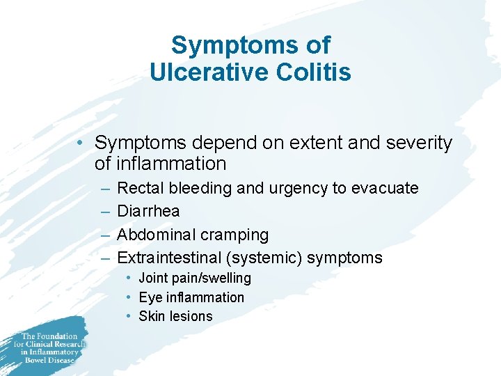 Symptoms of Ulcerative Colitis • Symptoms depend on extent and severity of inflammation –