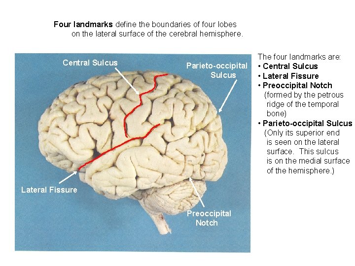 Four landmarks define the boundaries of four lobes on the lateral surface of the