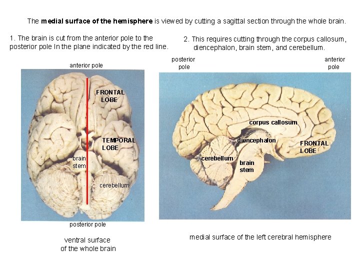 The medial surface of the hemisphere is viewed by cutting a sagittal section through