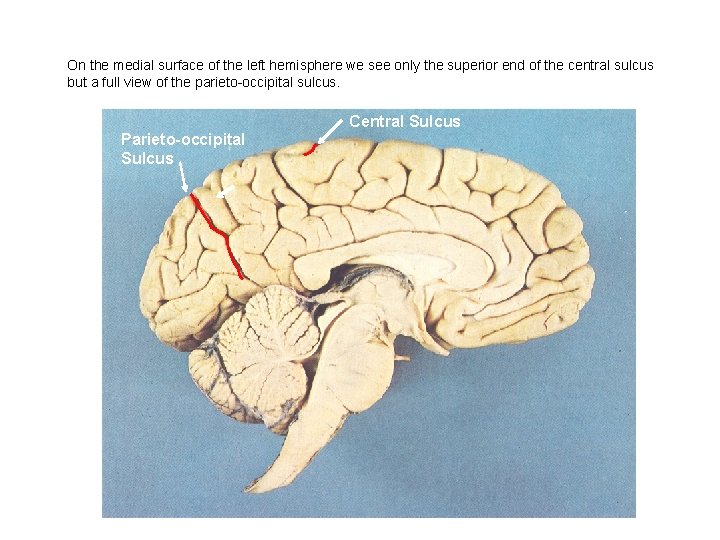 On the medial surface of the left hemisphere we see only the superior end