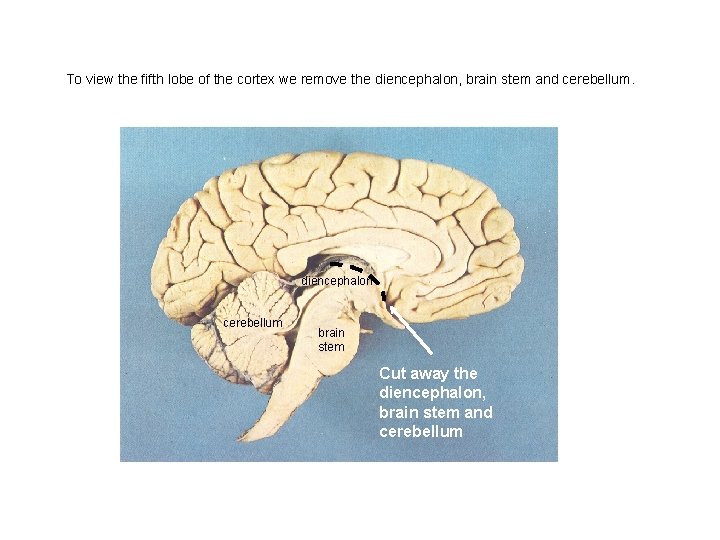 To view the fifth lobe of the cortex we remove the diencephalon, brain stem