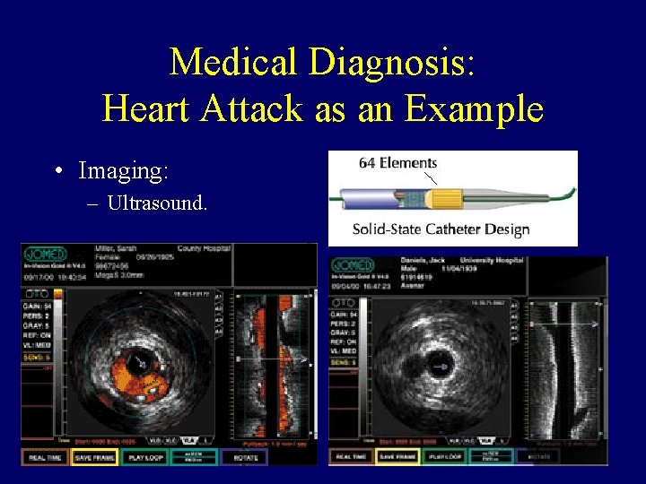 Medical Diagnosis: Heart Attack as an Example • Imaging: – Ultrasound. 