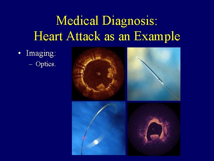 Medical Diagnosis: Heart Attack as an Example • Imaging: – Optics. 