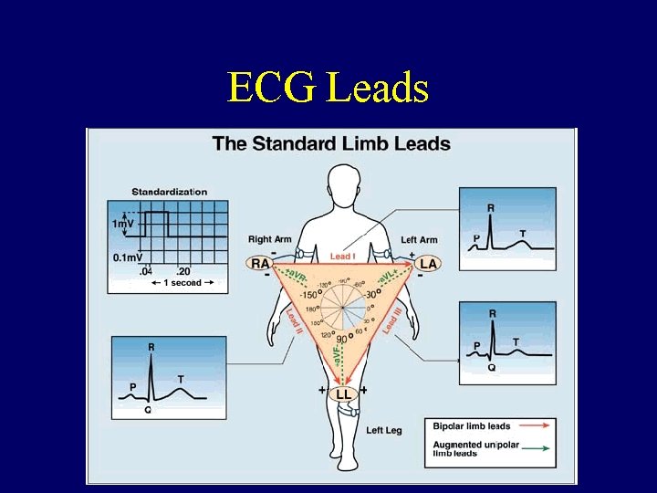 ECG Leads 