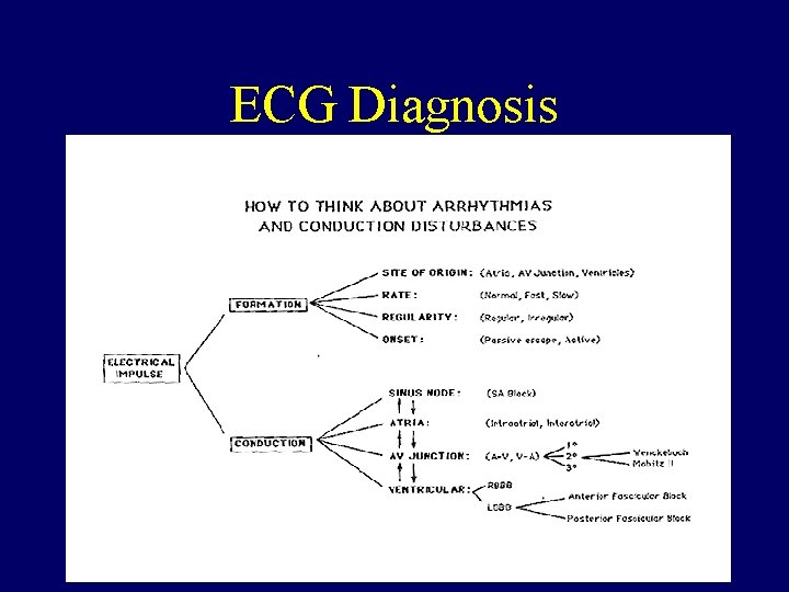 ECG Diagnosis ECG Diagnosis
